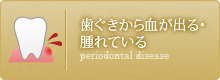 歯ぐきから血が出る・腫れている