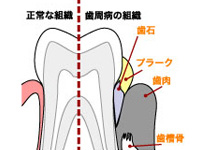 直接的な原因